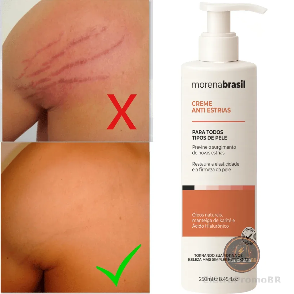 Creme Anti-Estrias Morena Brasil - Ação Poderosa com Colágeno e Elastina